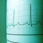 Cohérence cardiaque : la technique de respiration la plus étudiée contre le stress Cohérence cardiaque : la technique de respiration la plus étudiée contre le stress