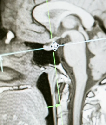Méditation et cerveau : ce que les neurosciences ont confirmé Méditation et cerveau : ce que les neurosciences ont confirmé