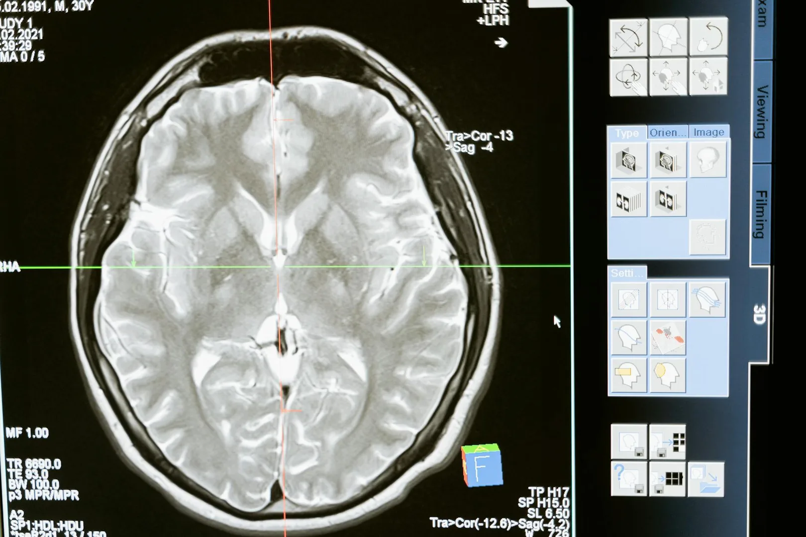 Méditation et cerveau : ce que les neurosciences ont confirmé