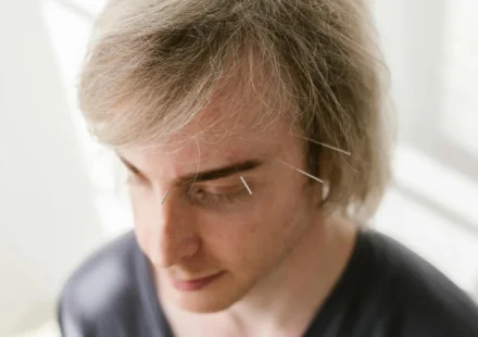 EFT et tapping : la technique des points d’acupuncture contre l’anxiété EFT et tapping : la technique des points d'acupuncture contre l'anxiété