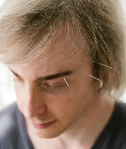 EFT et tapping : la technique des points d’acupuncture contre l’anxiété EFT et tapping : la technique des points d'acupuncture contre l'anxiété