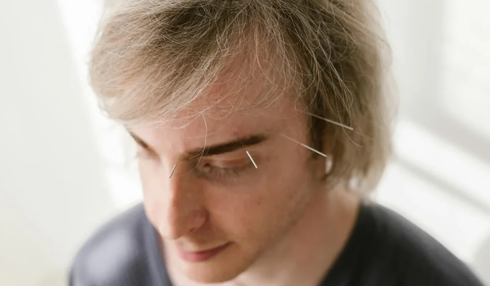 EFT et tapping : la technique des points d'acupuncture contre l'anxiété